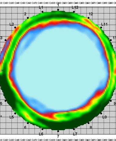 Tomograf / diagnostyka drzew